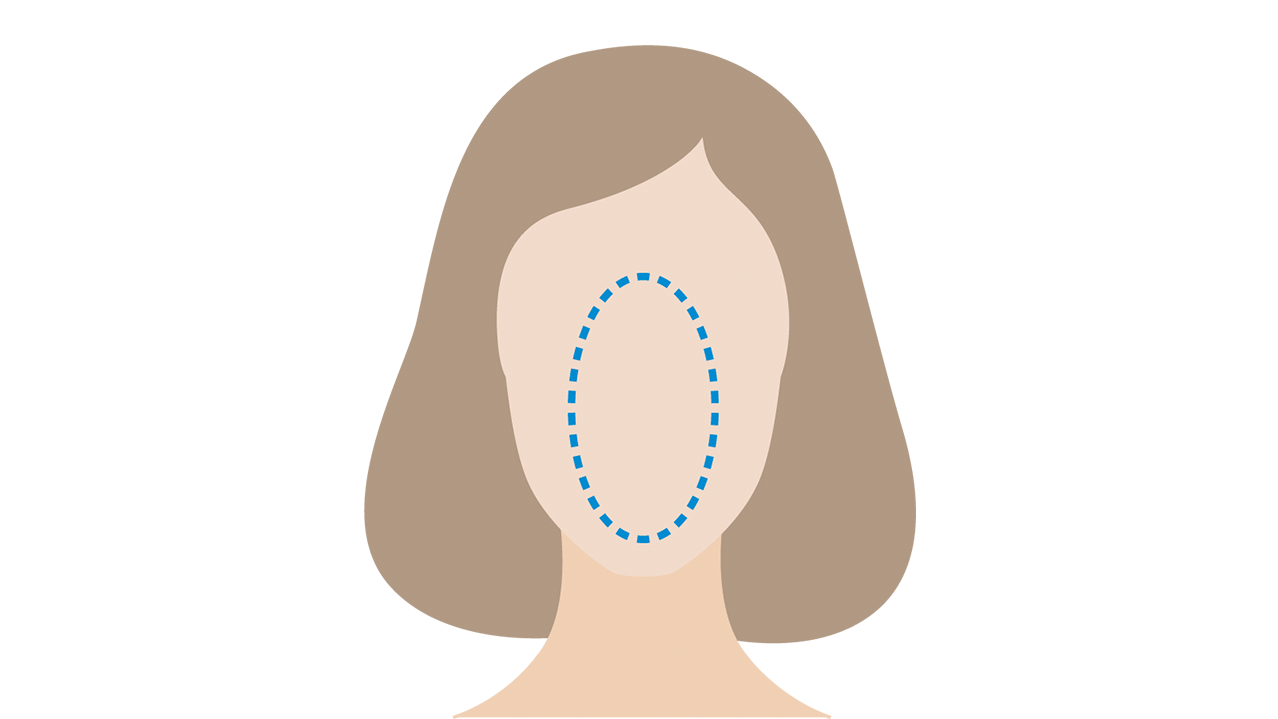 Longitudinal or rectangular faces